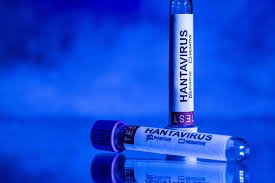 Tubes d’analyses médicales utilisés dans le cadre des tests liés à l’hantavirus en France.