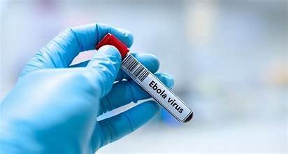 Tube de prélèvement portant l’inscription “Ebola virus”, tenu par une main gantée dans un environnement médical.